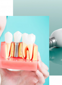 Dental Implants Sydney | Tooth Implants | Sydney Dental Implant Centre