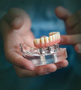 Dental Implants Sydney | Tooth Implants | Sydney Dental Implant Centre